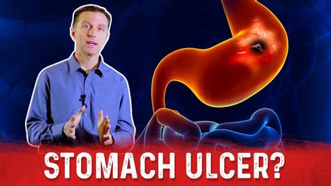 An <b>ulcer</b> can temporarily heal without antibiotics. . How long does it take for a stomach ulcer to kill you
